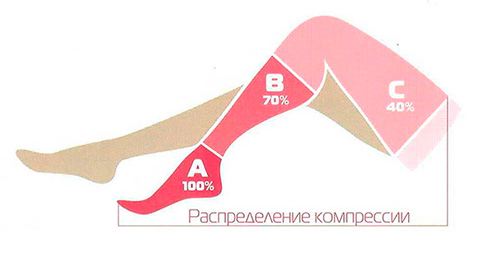 Как подобрать размер чулок компрессионных «Центр Компресс» 2 класс